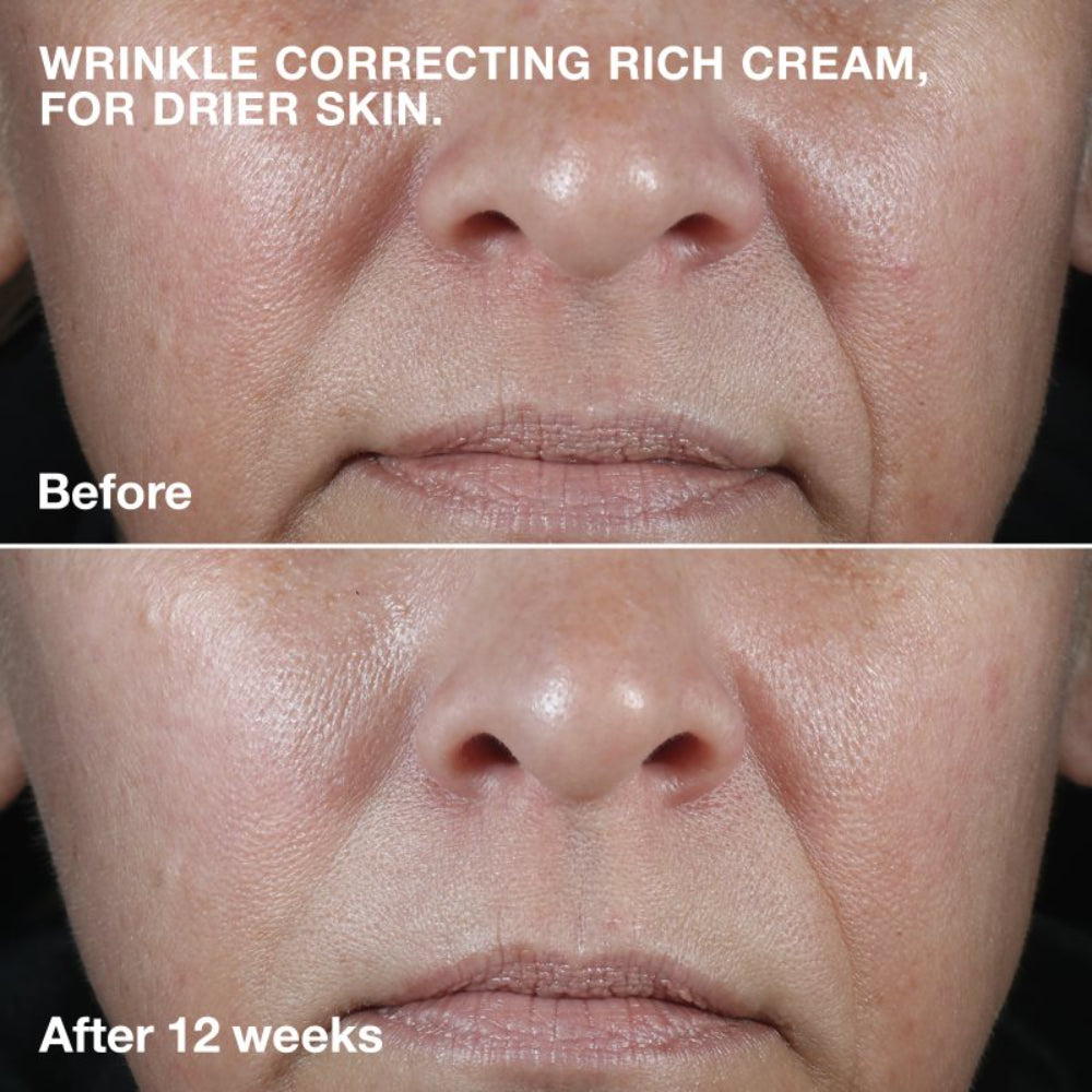 Clinique Smart Clinical Repair Wrinkle Correcting Cream